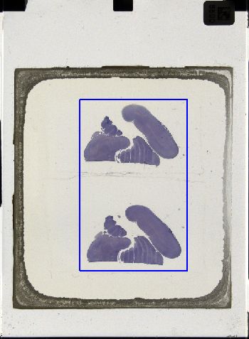 Media type: image; Special Collections 3043   shows specimen_part histological serial section;